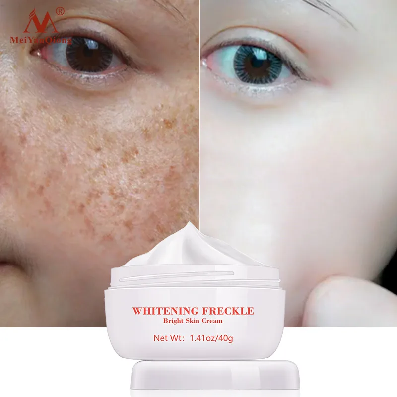 

1pcs Anti Aging Face Care Cream Dark Spot Remover Skin Lightening Cream Dark Skin Care Anti Freckle Whitening Cream