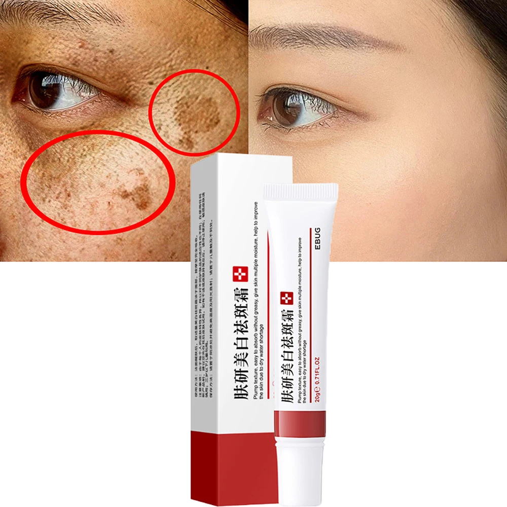 

Remove Dark Spots Fade Freckle Cream Anti Acne Whitening Ointment Fade Pigmentation Anti Melasma Brighten Skin Care Creams 20g