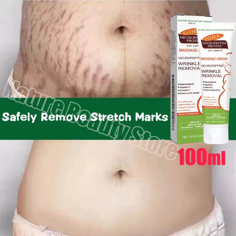 Крем для удаления растяжек восстановление беременных женщин антивозрастной