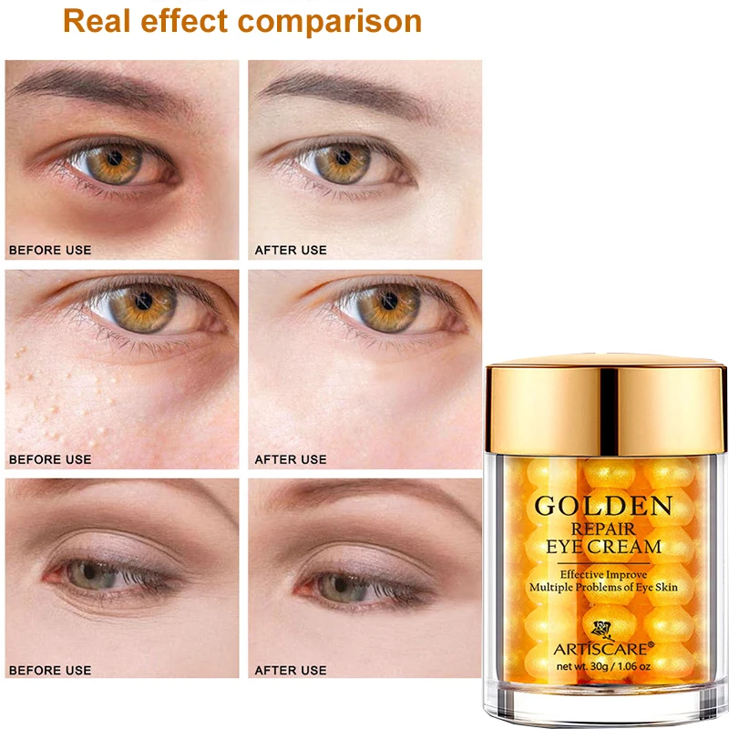

ARTISCARE Golden Eye Cream Moisturizes Eyelines, Black Circles, and Bags