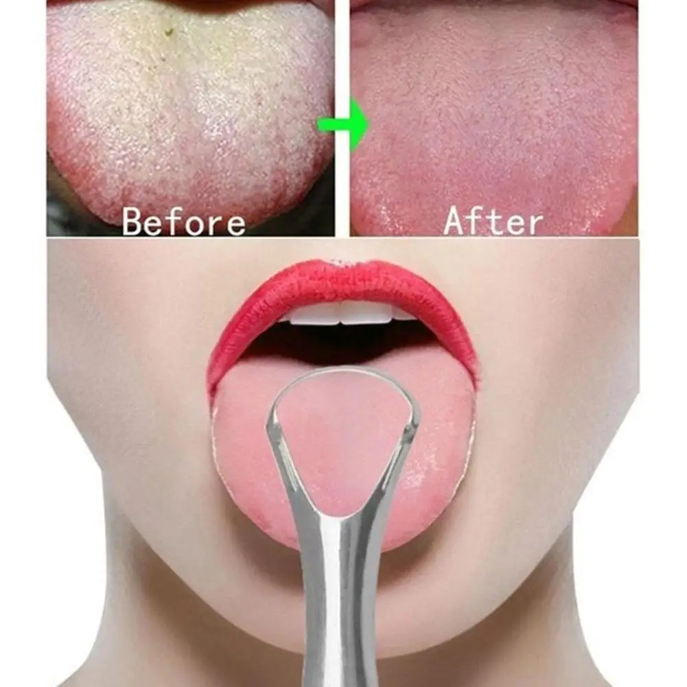 Y-Kelin Hot Sale Stainless Steel Tongue Scraper Metal Brush Fresh Breath Oral Care Cleaner Reusable Eco-friendly & V8Y8