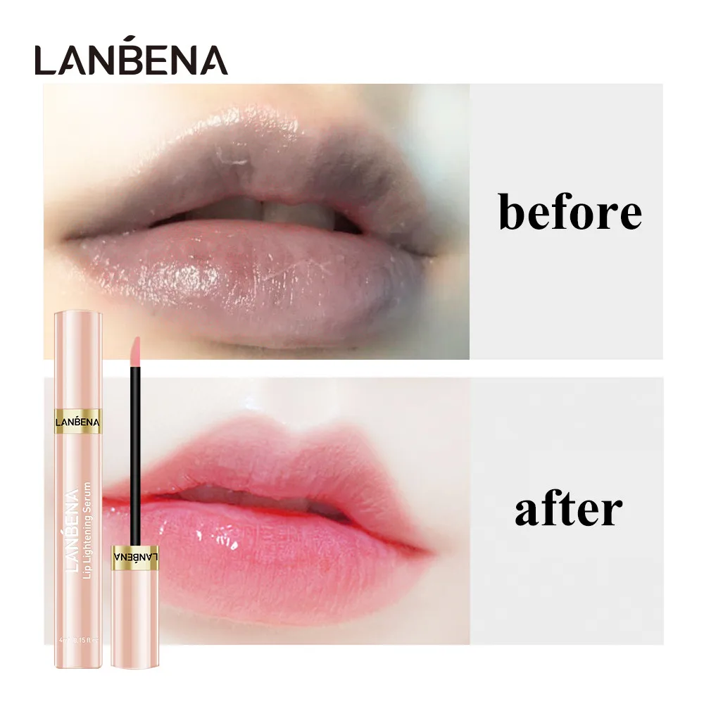 LANBENA Lip Lightening Serum Plumper Gloss Cherry Reduce Fine Lines Remove Melanin Pink Lips Plumper Moisturizing Lip Enhancer