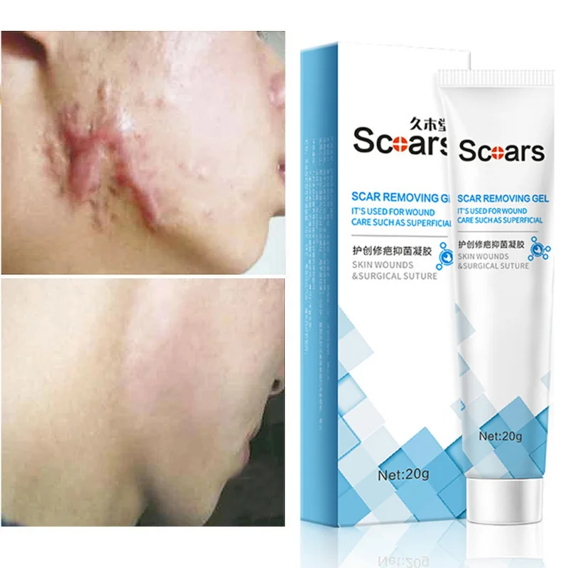 

Бриллиантовый крем для удаления шрамов, растяжек, удаление геля, сжигание лица и тела, хирургические рубцы, удаление лечения, увлажняющая сы...