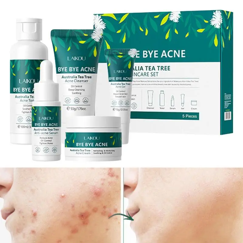 

Facial Skin Care Kit For Women Tea Tree Pimple Acnes Removing Essence 5pcs/set Shrink Skin Pores Face Essence Beauty Set
