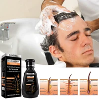 hair growth shampoo prevent hair loss promote growth deep cleaning oil control dandruff repair supple deep nourishment 250ml