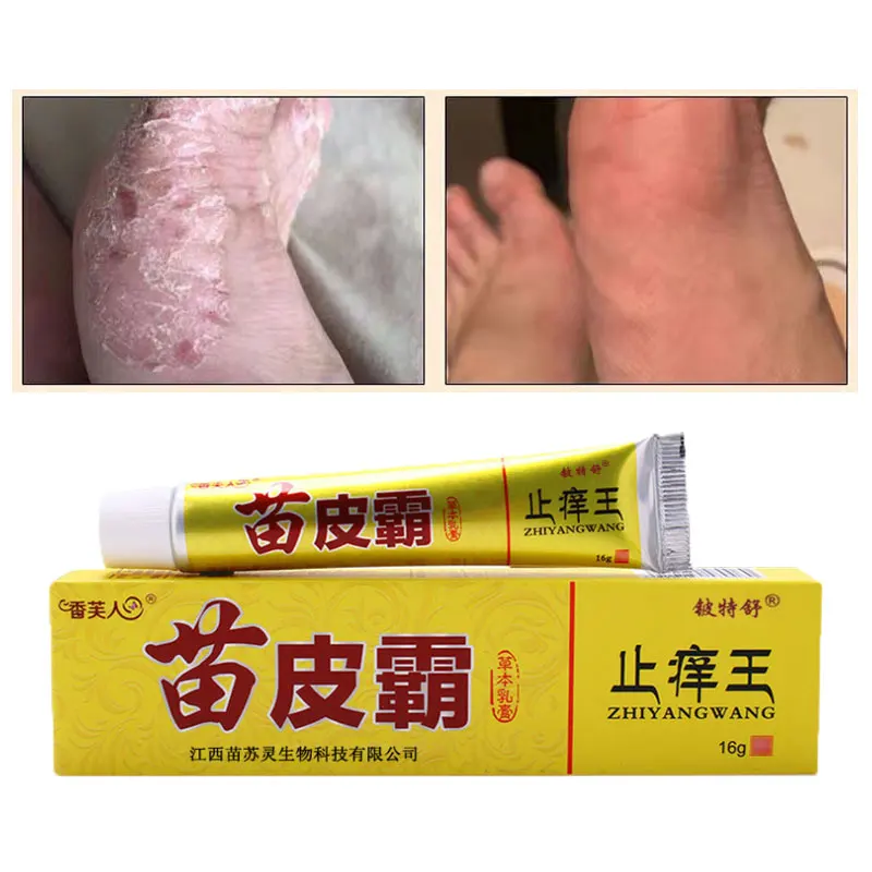 

Anti-Itch Eczematoid Urticaria Body Skin Treatment Against Psoriasis Eczma Cream Natural Herbal Ointment Antibacterial Gel