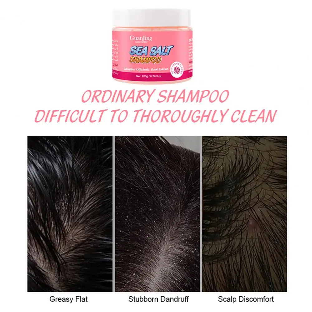 

Scalp Care Improve Growth Against Itchy Scalp Relief Anti-Dandruff Shampoo for Adult