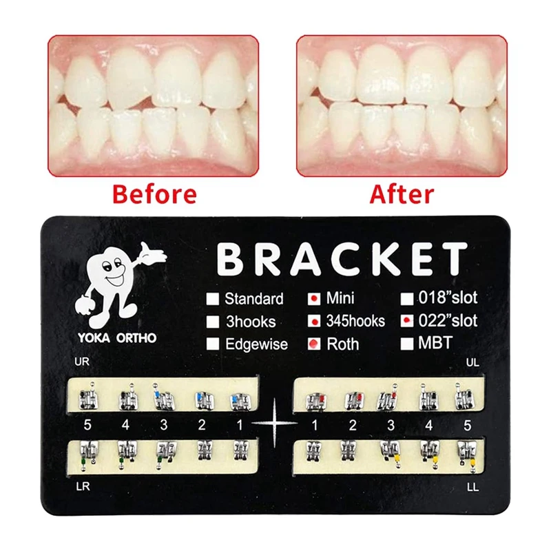 Мини кронштейны Roth модели зубцов 022 200 шт. слот выдвижной с крючком на 345