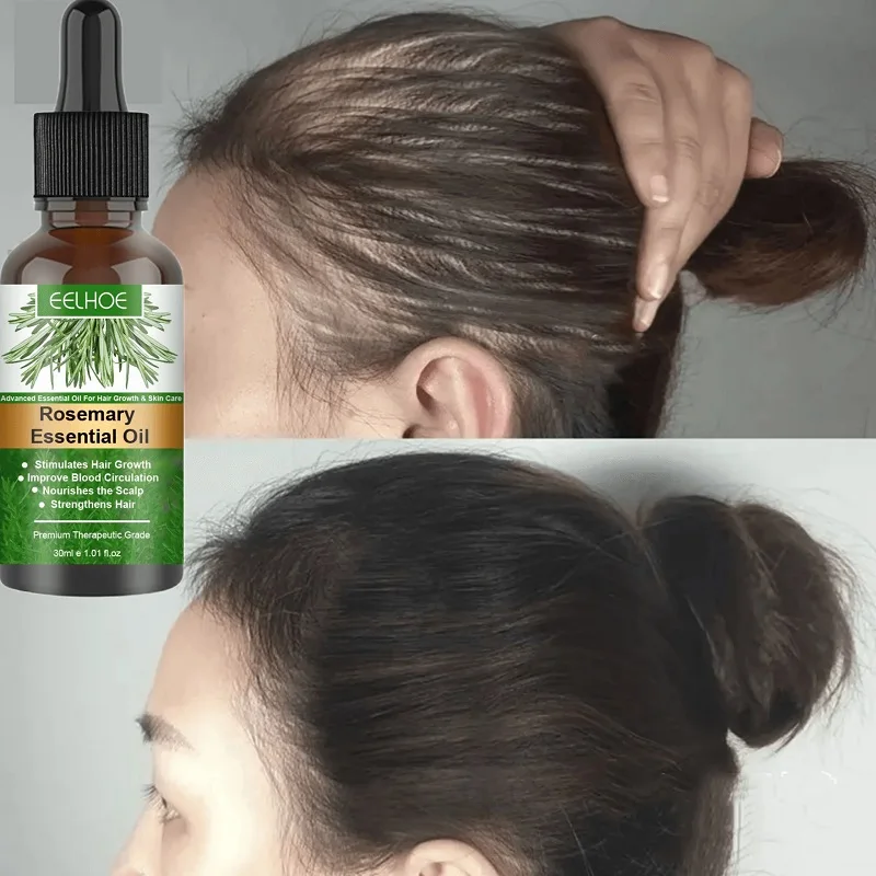 

Powerful Hair Growth Essential Oil Anti Hair Loss Fast Growing Germinal Serum Repair Damage Oil Baldness Scalp Treatment Product