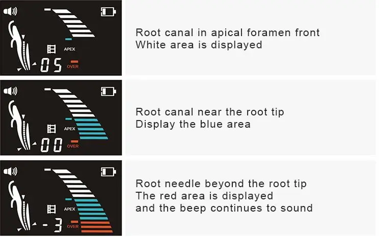 Высокое качество Den tal Endo локатор вершины корневых каналов 4 5 ЖК-дисплей Scteen