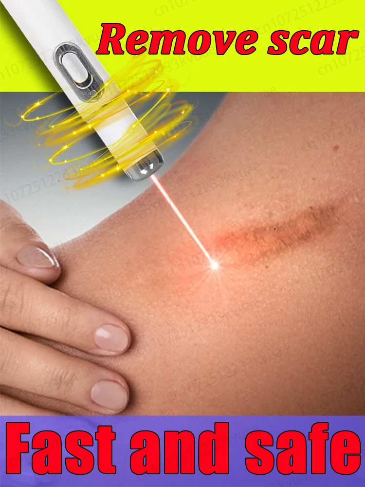 Лазерное удаление рубцов