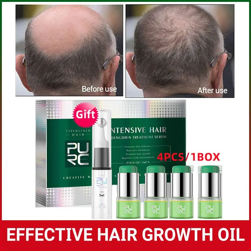 

PURC Ginger Hair Growth Serum Set Bald Regenerating Anti Hair Loss Essence Thick Treatment Man Woman Scalp Dry Hair Care 4PCS