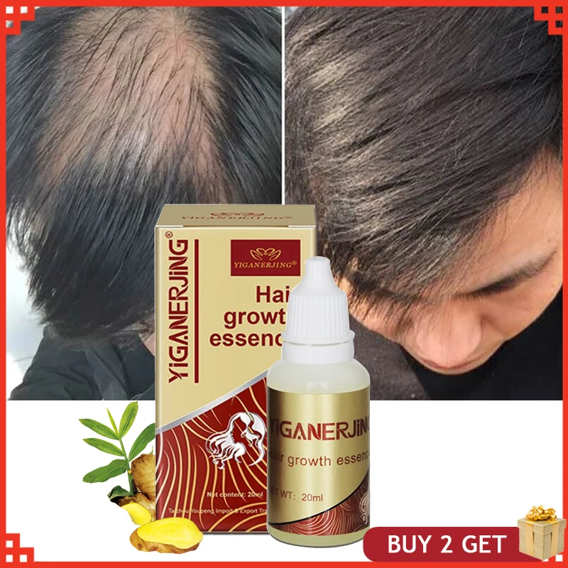 

Продукты для роста волос Sdatter, китайские травяные эфирные масла, эссенция для выпадения волос, жидкое лечение истончения волос для мужчин и женщин, 30 мл