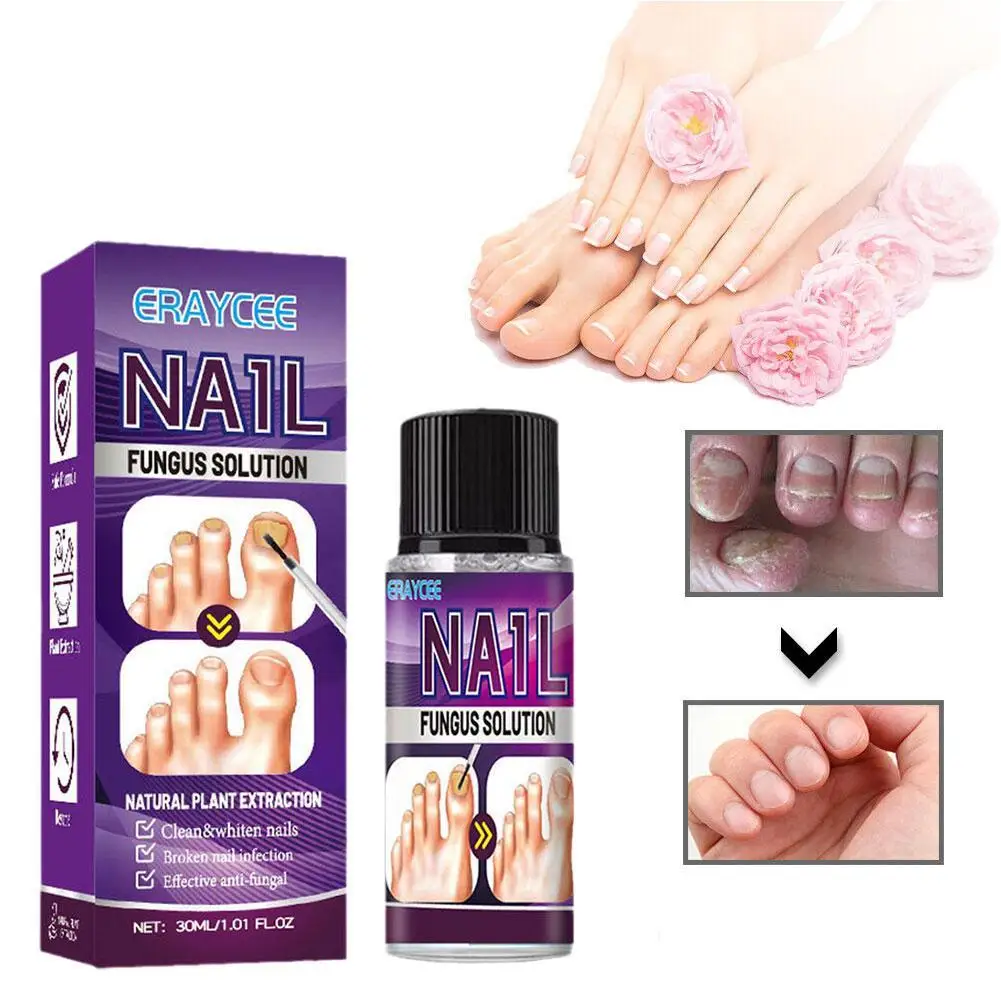 

30ml Nail Repair Essence Nail Growth Polish Fingernail Repair Promotes Onychomycosis Nutrition Strengthen Nails Essence Care