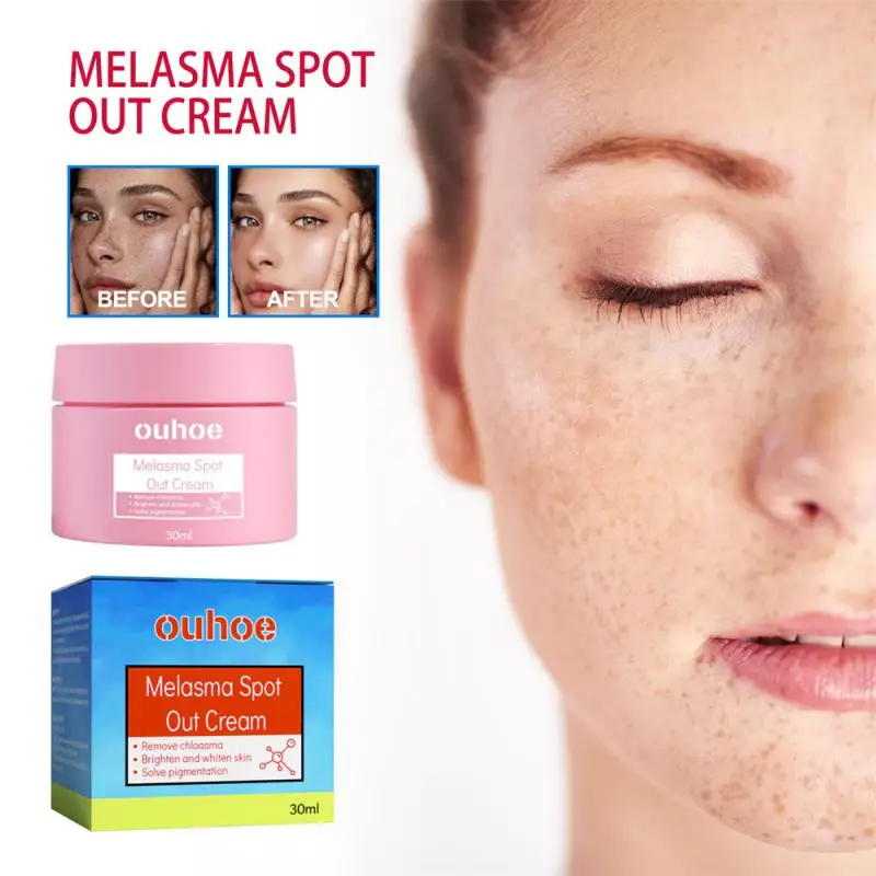 

NEW Whitening Face Cream 20% Vitamin C Repairs Lightens Freckles Removes Black Spots Melanin Brightens Face Cream