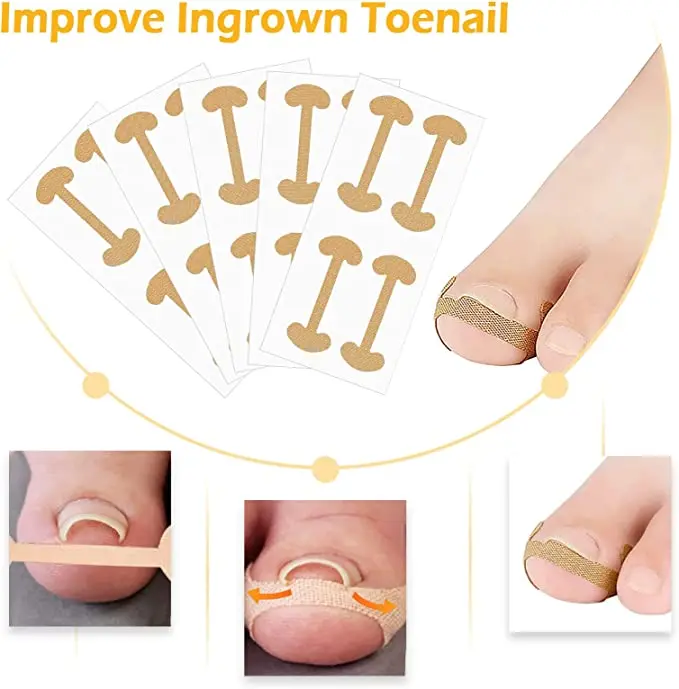 

10 Pieces Ingrown Toenail Adjustment Stickers Breathable Patch Health Care