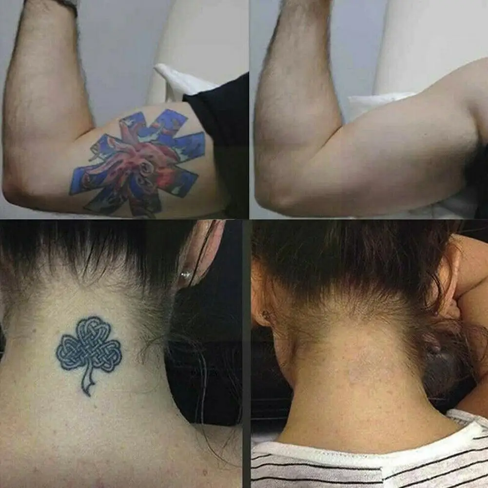 

4 Week Tattoo Removal Cream Afe Permanent Moisturize Body Gel Skin Maximum Remover Painless Strength Tattoo Cleaning Tattoo R5U6