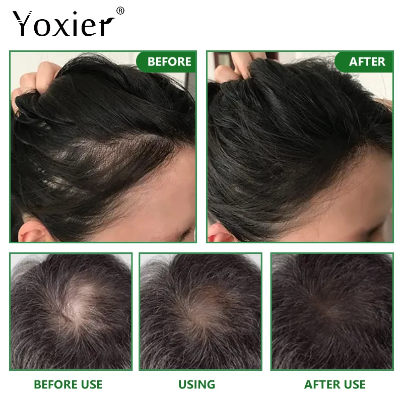 Крем для снятия перхоти и зуда 80 г |