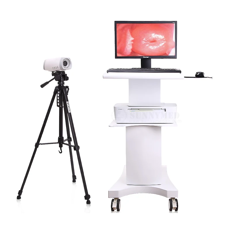 

SUNNYMED SY-F004 Hospital Digital Video Portable Gynecological Colposcope