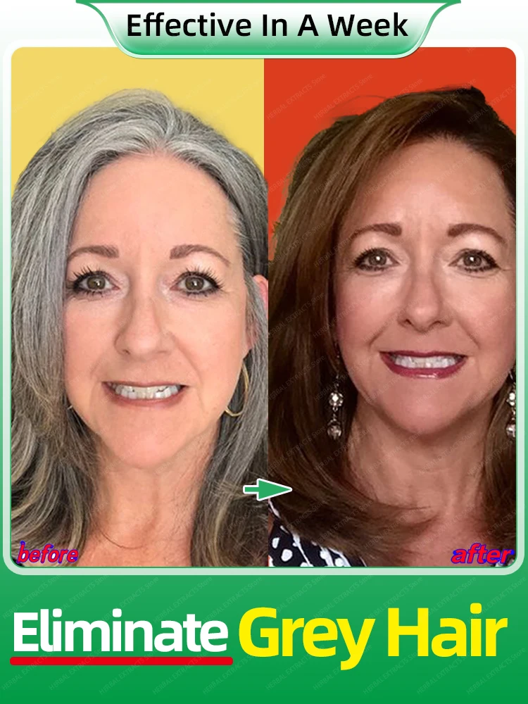 

Anti Gray Hair Remedy Serum White Hair Treatment