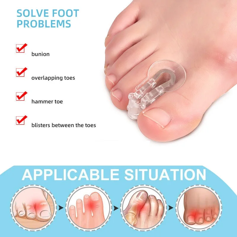 

1/2 pcs Toe Splitter Thumb Valgus Corrector Big Foot Bone Orthosis Clip Toe Pad Toe Overlap Separator Transparent Toe Splitter