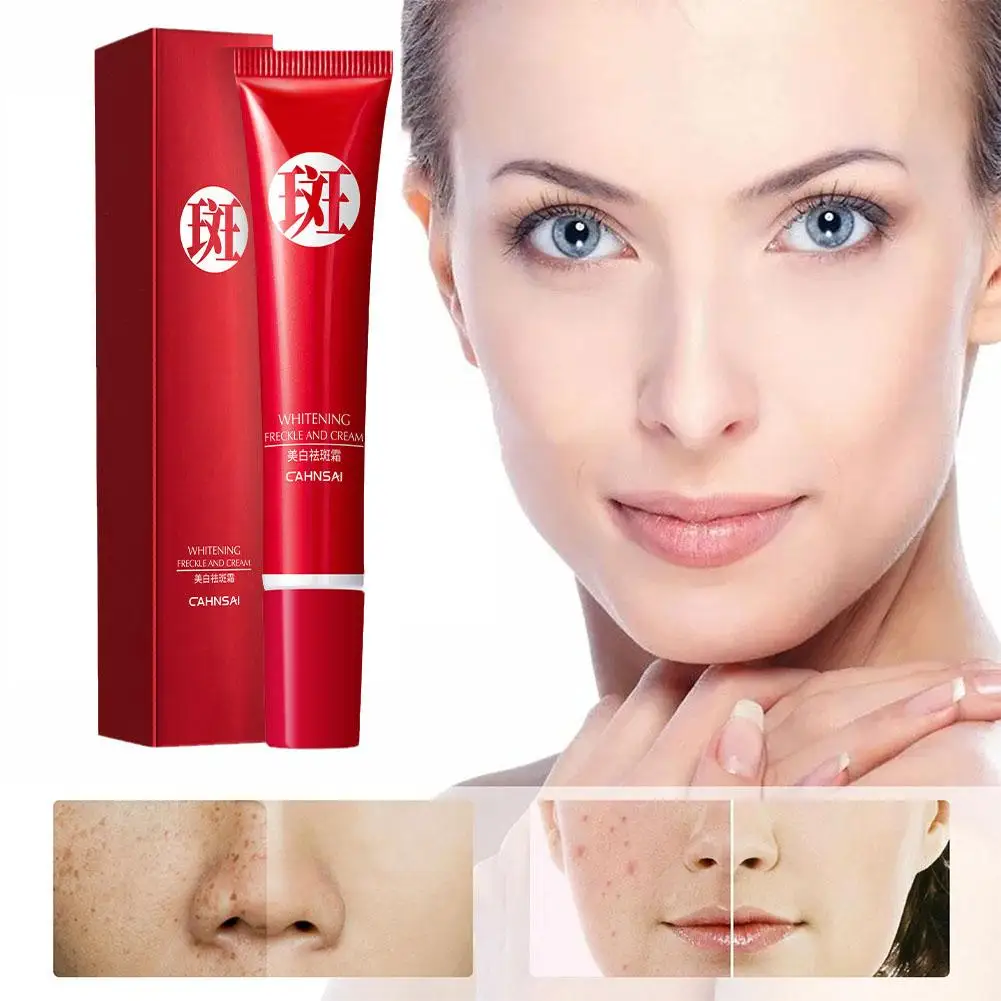 

Whitening And Freckle Removing Cream Hydrating Moisturizing Brightening Mark Skin Fade Repair Moisturizing Whitening Acne M J1G6