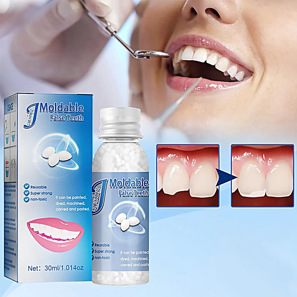 

Полимерный клей для ремонта зубов, корректируемые зубные зазоры, заполнение, твердый клей, Временный ремонт зубов, клей для накладных зубов, безопасные Стоматологические принадлежности