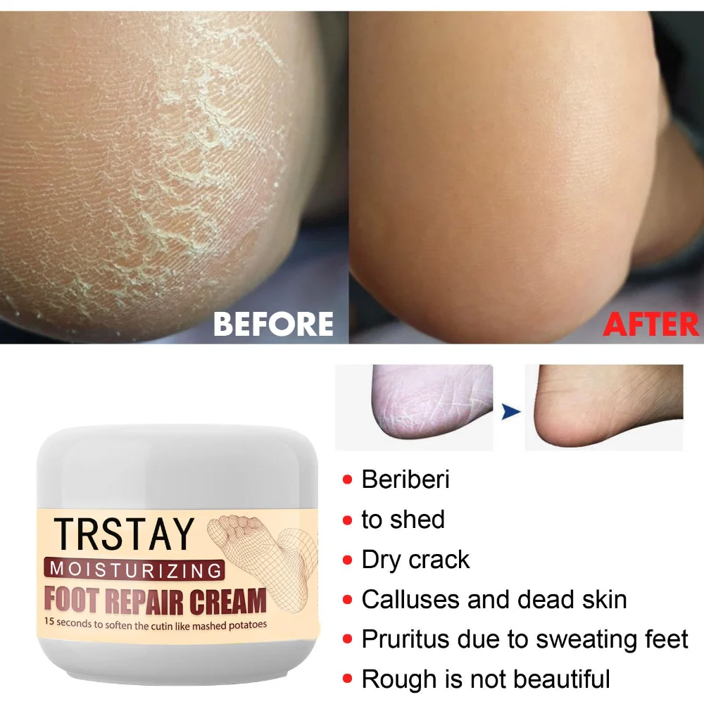 

TRSTAY pedicure cream moisturizing repair heel dry cracked peeling anti-cracking foot care cream