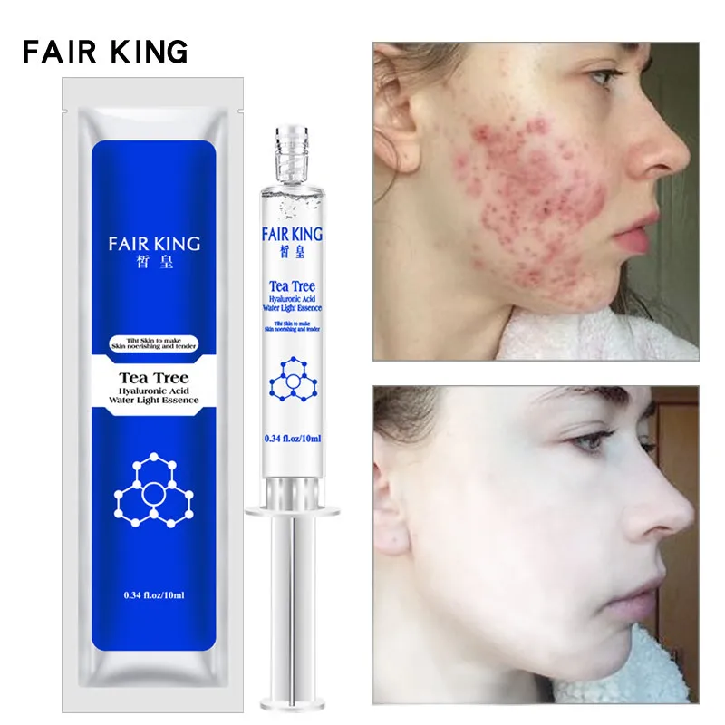 

Умная Сыворотка для удаления кожи, эффективная увлажняющая эсенция для лица, гель для сужения, акне, лечение и уход за кожей