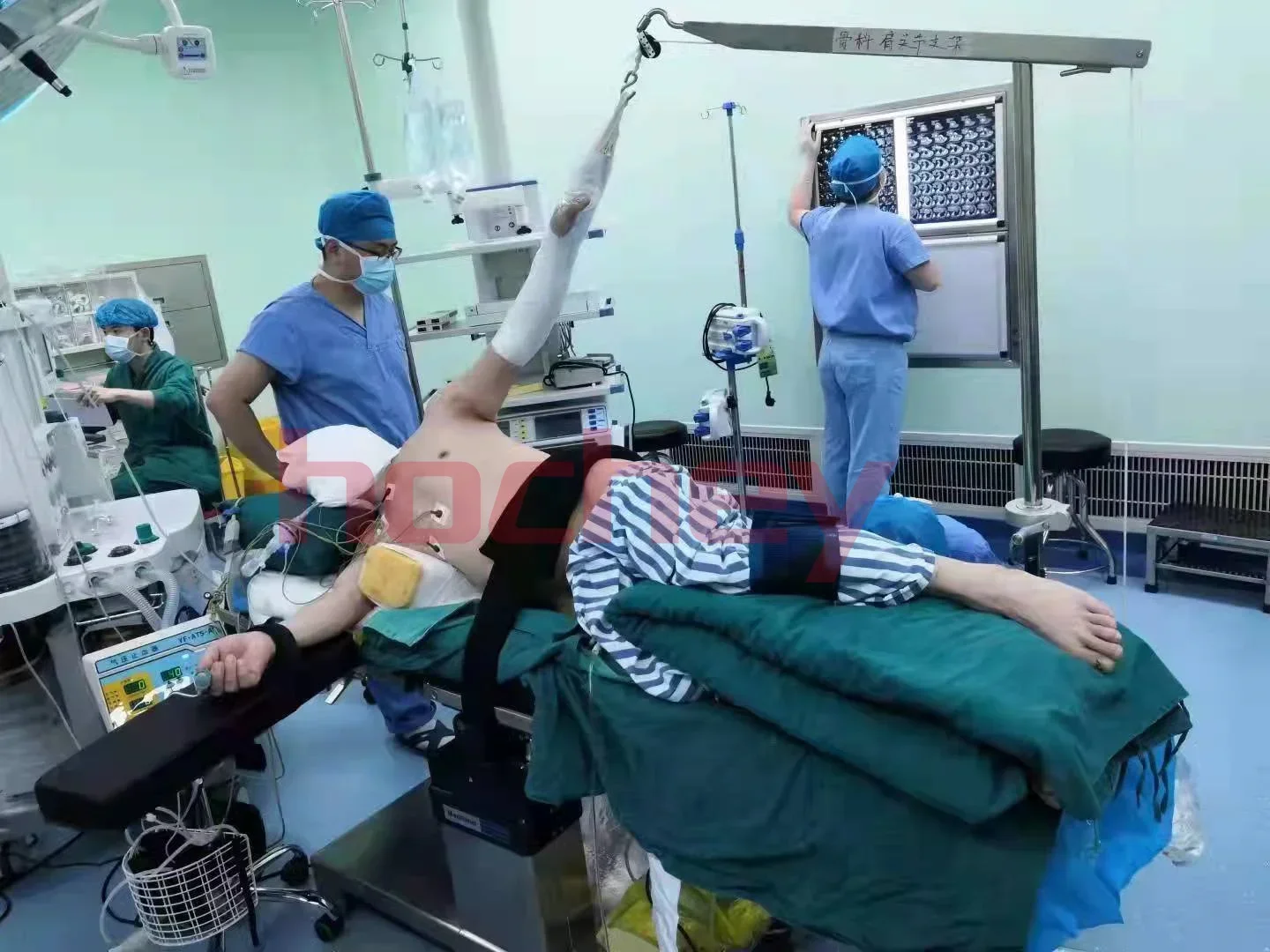 Детали для операционного стола поддержка артроскопии плеч операционная рама