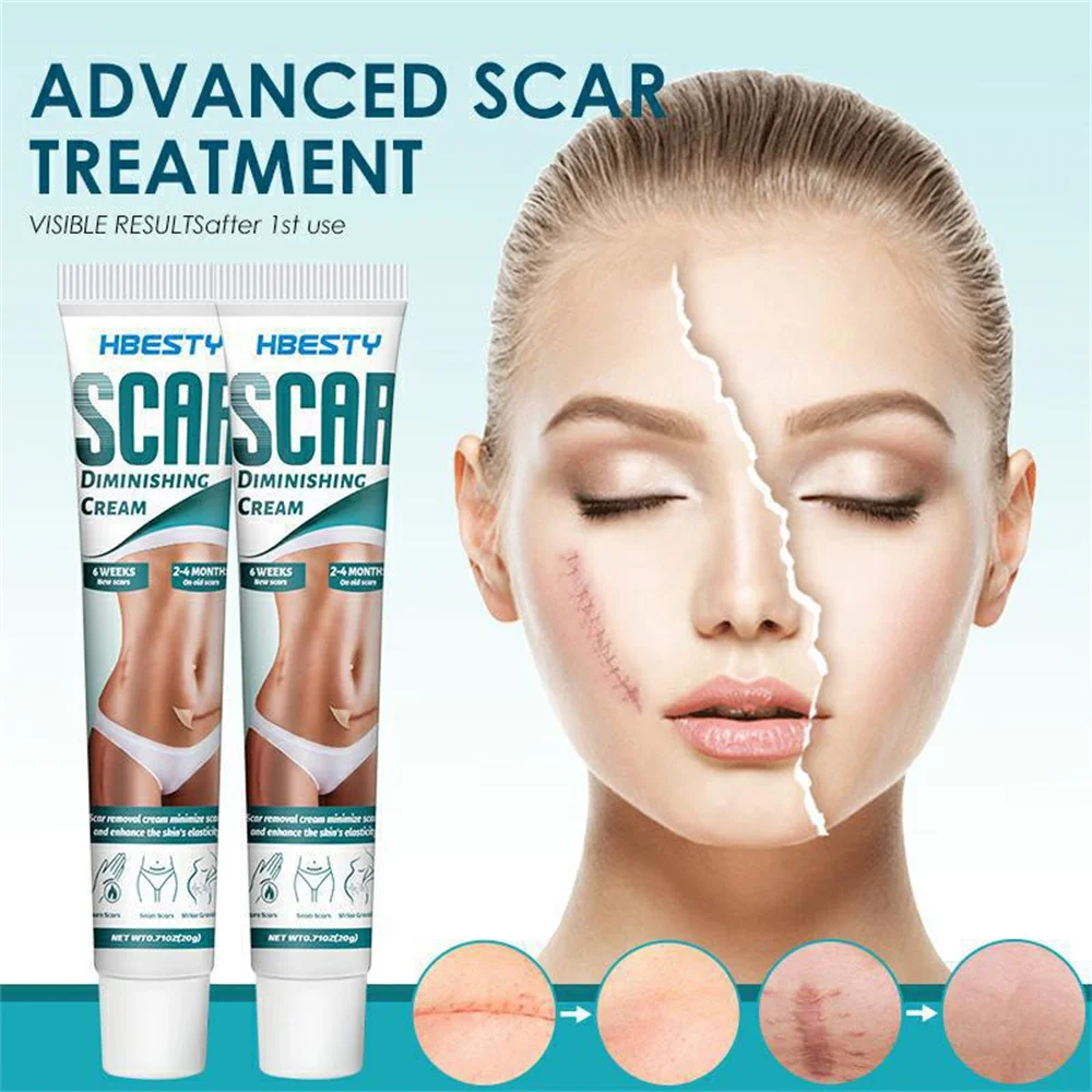 

Scar Care Cream Strong Permeability 3 * 12cm Scar Gel Facial Care Scar Cream Gentle And Skin Friendly Universal 20g