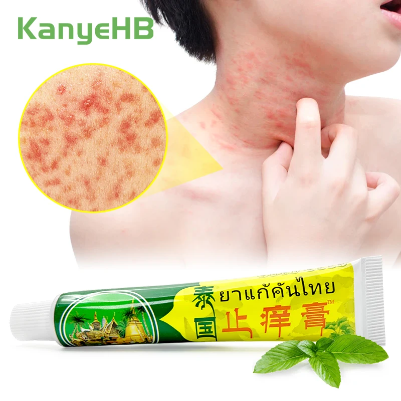

1pcs Antibacterial Cream Psoriasis Treatment Ointment Relieve Fungus Eczema Rash Urticaria Herbal Itching Thailand Products S074
