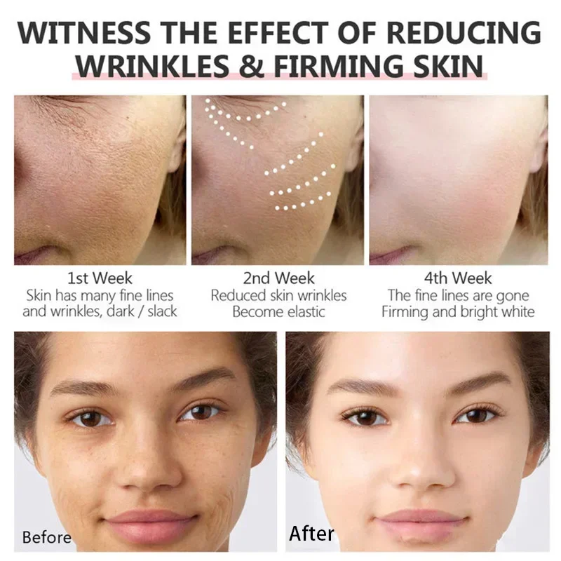 01 Сыворотка для минимизации пор кислота сужение удаление черных точек с больших