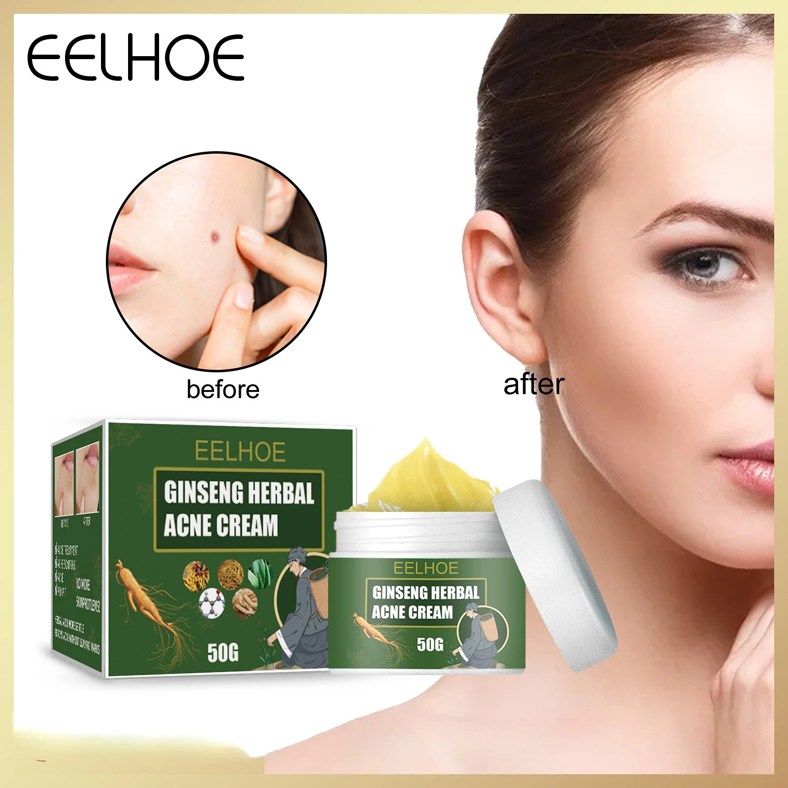 EELHOE Ginseng Herbal Acne Cream, Clean and Brighten Skin, Lighten Acne Scars, Repair Acne Pits and Gently Improve Acne Skin