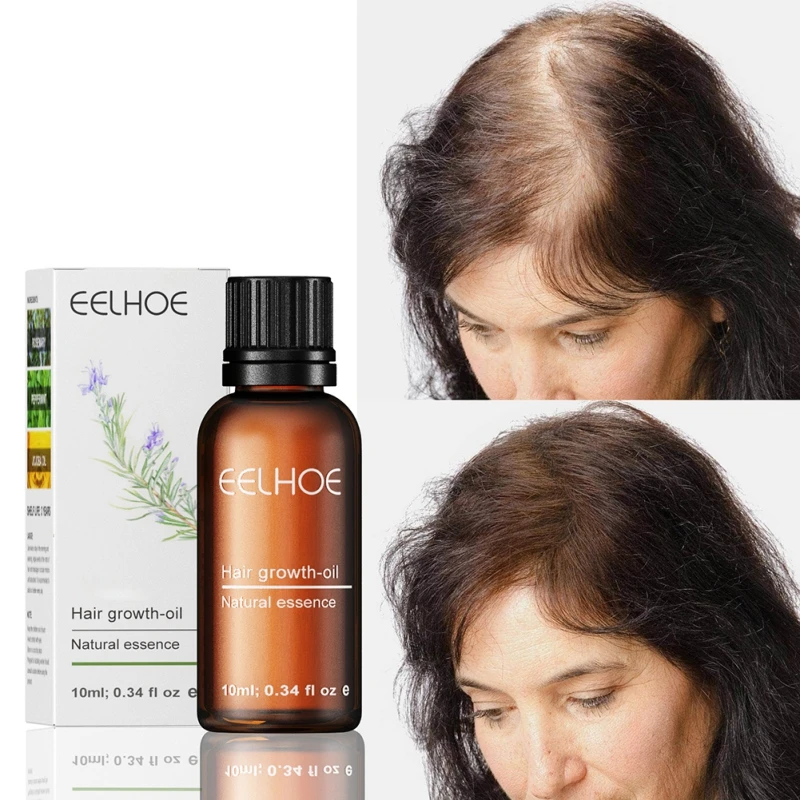 

10ml Hair Growth Serum for All Hair Types Anti Hair Loss Thickening Hair Oil Hair Treatment Oils Deep Moisturizing
