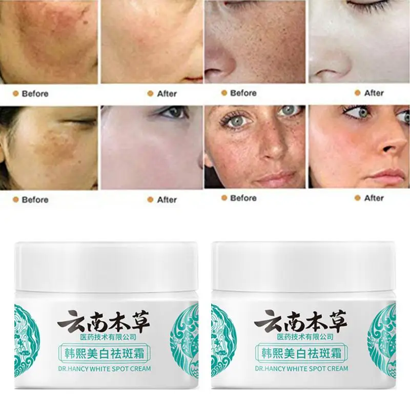 

20/30/50g Herb Powerful Whitening Cream Freckle Remove Acne Spots Melanin Dark Spots Face Moisturizing Face Skin Care Beauty