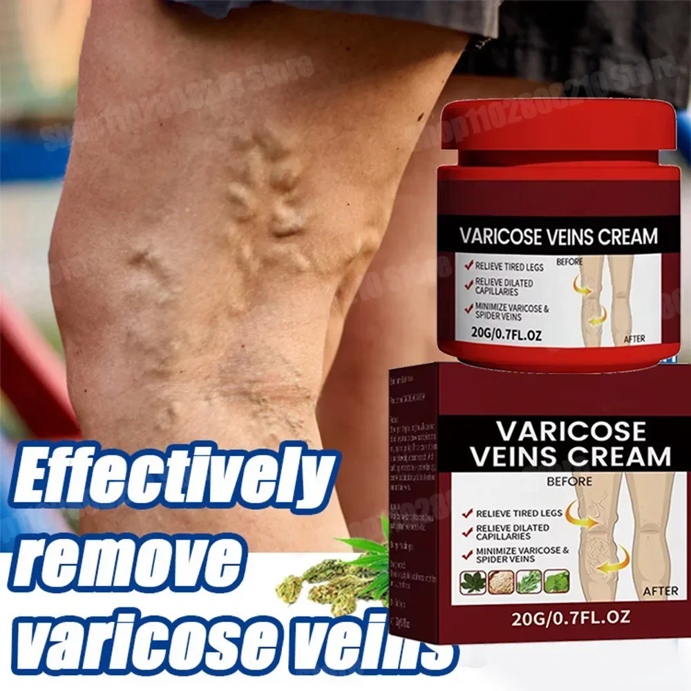 Антибактериальный крем от псориаза дерматита экзематоида эффективный продукт