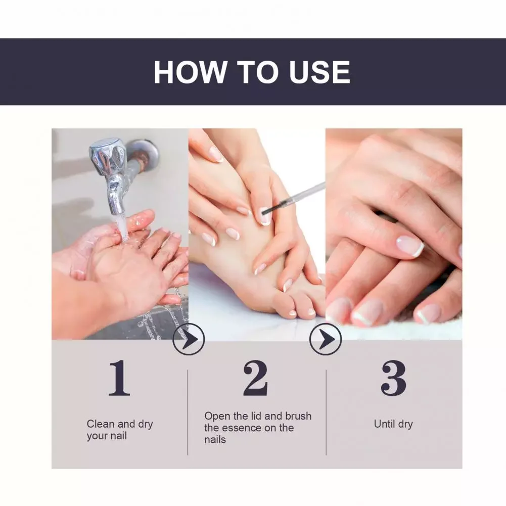 

NEW Nail Repair Serum Gentle Unisex Brighten Hand Foot Toes Nail Care Essence Feet Care