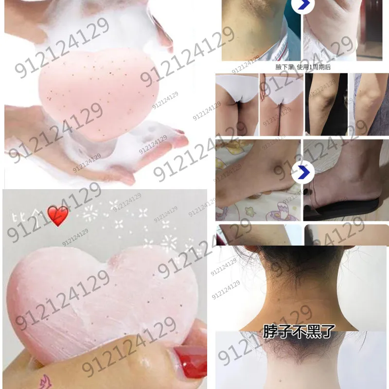 

80g OMY LADY Fast Skin Bleaching Cream Inner Thighs Inner Groin Whitening Peach Women Intimate Bath Body Scrub