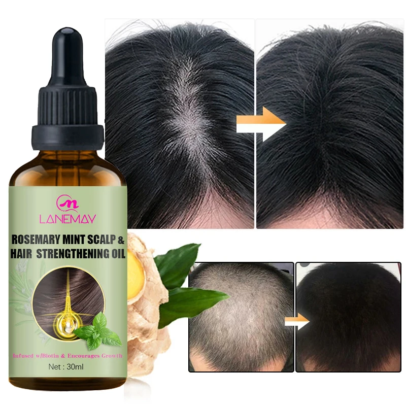 

Hair Growth Essential Oil Hair Regrowth Serum Hair Thinning Treatment Fast Hair Grow Liquid Anti-Hair Loss For Women & Men