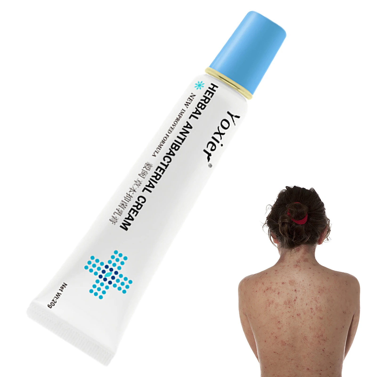 

Herbal Anti-microbial Cream Eczema Cream Anti-itch Relief Eczema Skin Rash Urticaria Desquamation Remedy Body Cream Body Balm