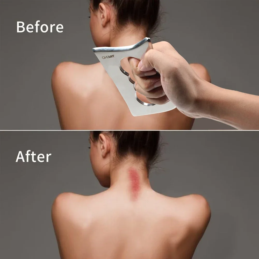 Инструмент для скребка из нержавеющей стали обновления мягких тканей средства