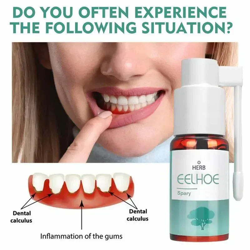 Спрей для зубной боли спрей полости рта снимает опухшие десны кровотение зубов