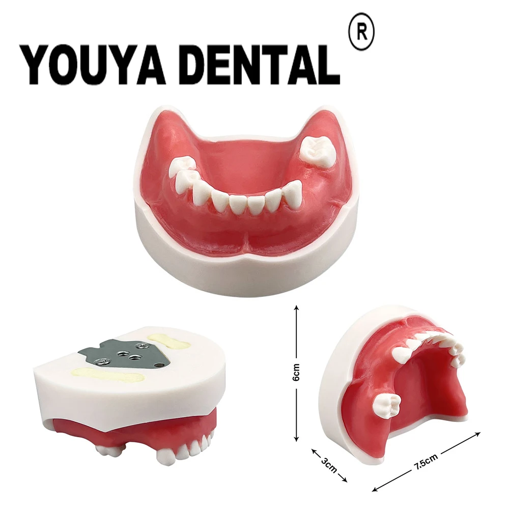 

Dental Implant Practice Model for Dentist Technician Student Teaching Training Studying Oral Medical Dentistry Tools