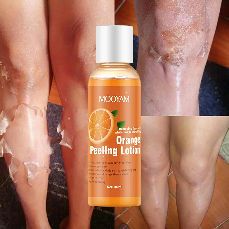 

Orange Peeling Lotion 100ml Body Whitening Exfoliating Gel Chamfer Essence Knee Underarm Dark Skin Care Rough Dry Keratin