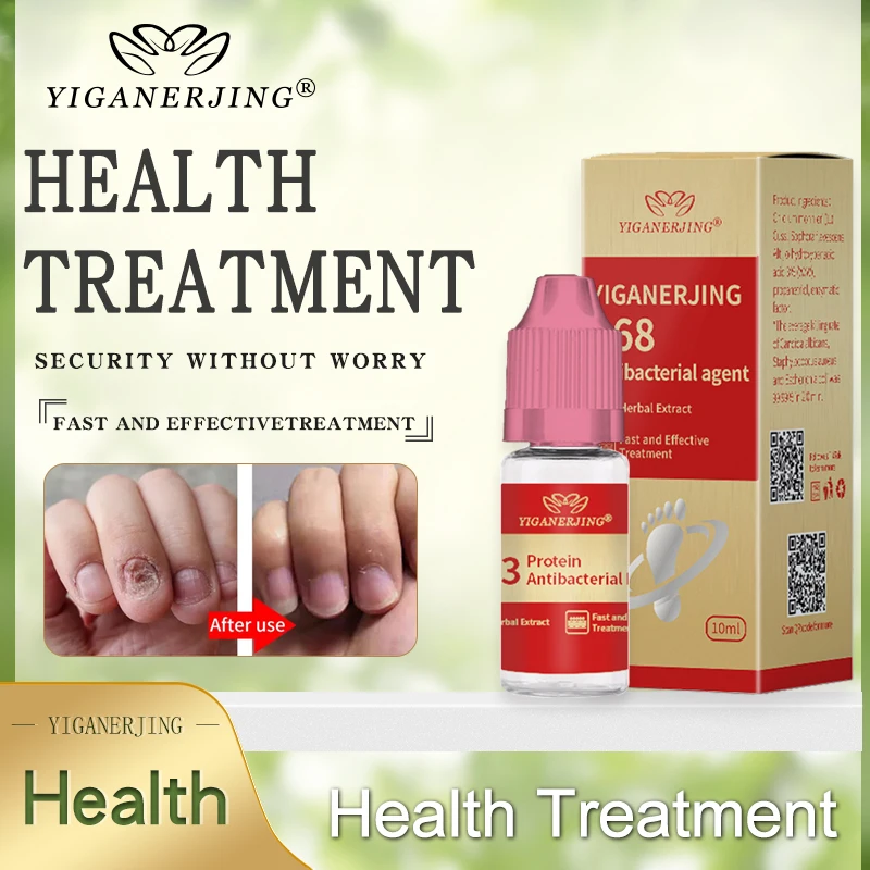 

368 + 863 Лечение ногтей от грибка Уход за ногами эссенция против инфекции паронихия онихомикоз гель для удаления грибка ногтей