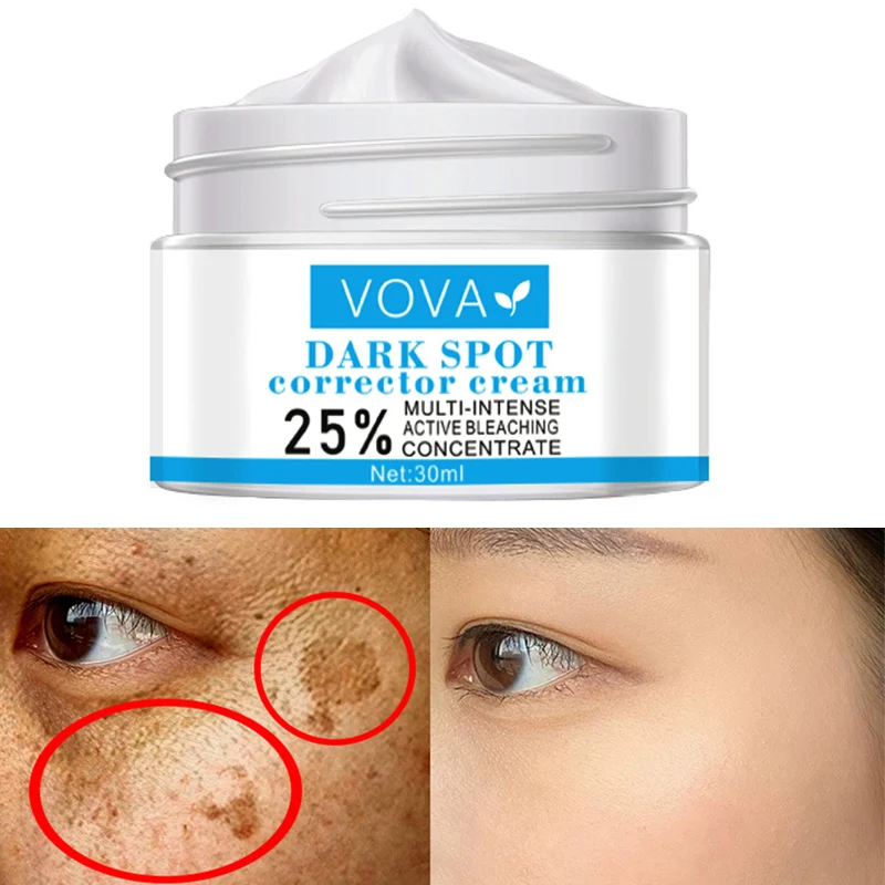 Dark Spot Removal Cream Whitening Skin Removal Melasma Acne Spot Pigment Melanin Dark Spot Pigmentation Moisturizing Gel 30g