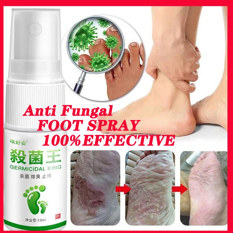 

Anti Fungal Foot Spray Bacterial Removal Infections Foot Spray Feet Care Athlete's Foot Sweaty Odor Itching Toe Care Spray