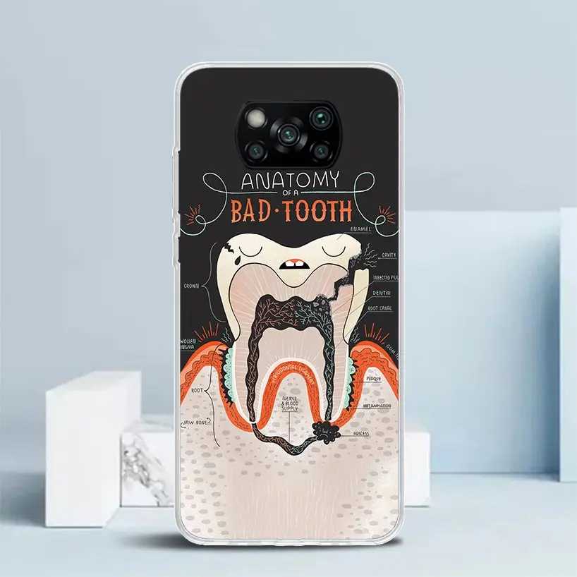 Чехол для телефона с зубами мудрости стоматолога Xiaomi Poco X6 X5 X4 X3 Nfc F6 F5 Pro F4 Gt F3 F2 F1 M5S