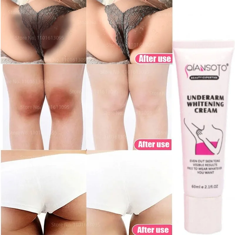 

Отбеливающий крем Private Parts, отбеливающий крем 60 г для рук, бедер, колен, отбеливание ярче кожи, мягкий, не раздражающий